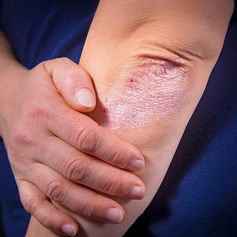 HackerDermatology_510954994_sq