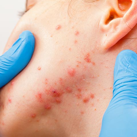 HackerDermatology_660804440_sq